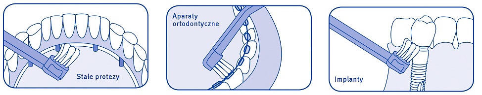 cs 708 implant ortho protezy hellodent