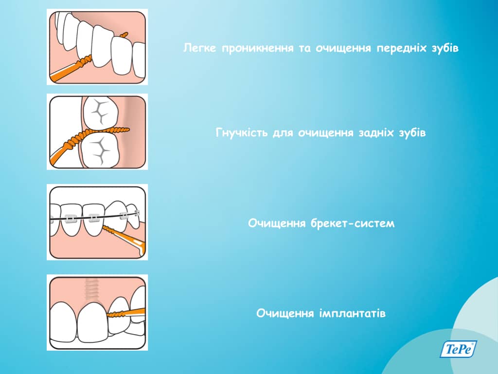 tepe_7317400085511_images_7524819696 1