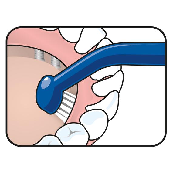 Tepe universalcare