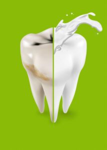 apacare