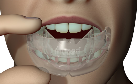 MRC myOSA TMJ-BDS S1 Mouldable