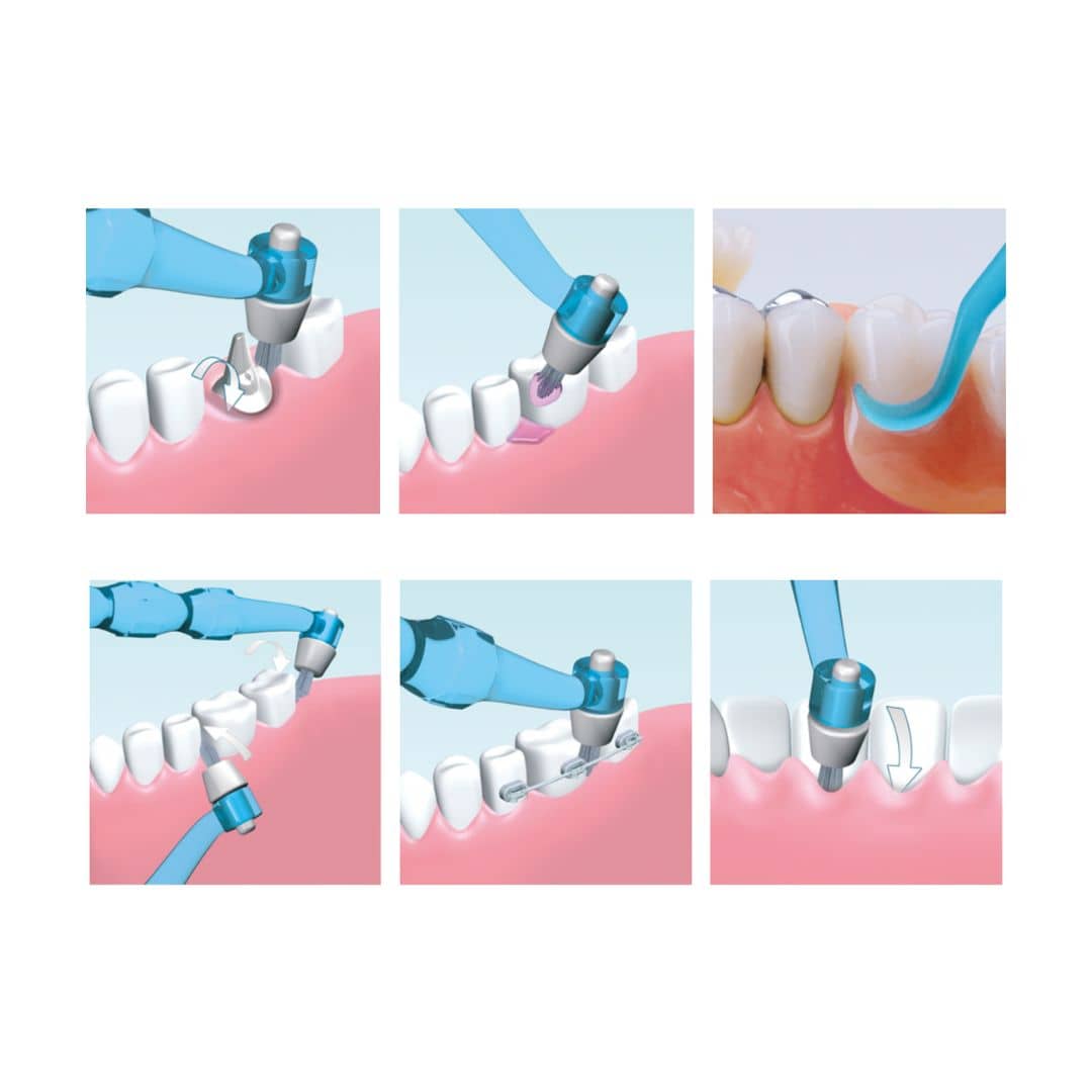 Interdental care