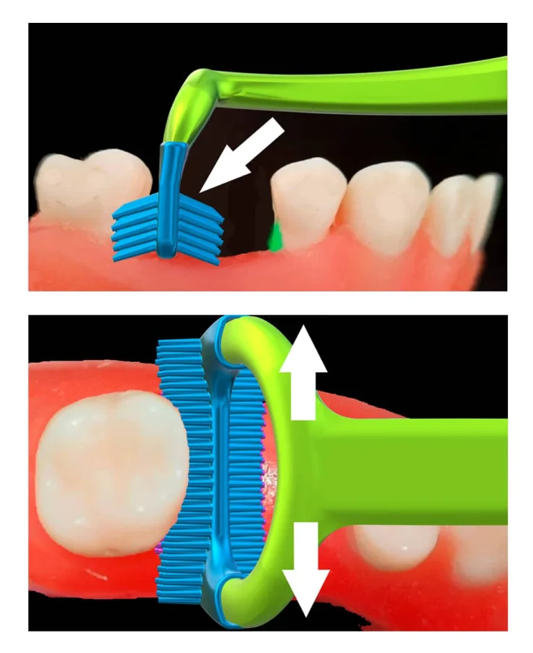 how-it-works-ergoprox-1